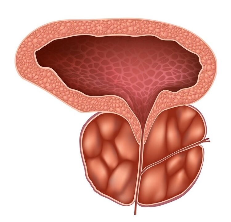 Τι είναι η προστατίτιδα και πώς να την αντιμετωπίσουμε